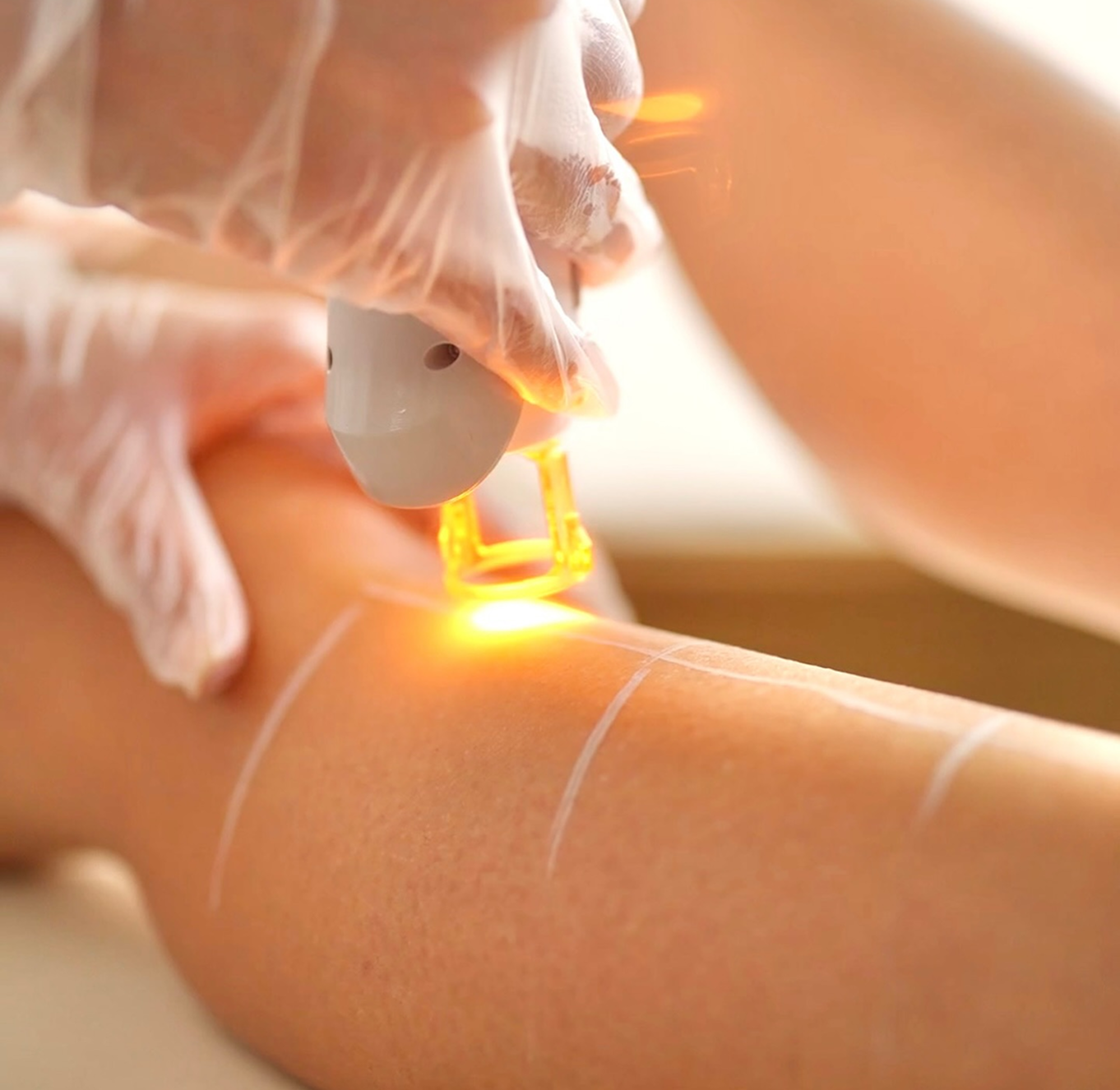 Maison du Laser - Centre d'épilation laser médical à Paris - Être recontacté par notre équipe